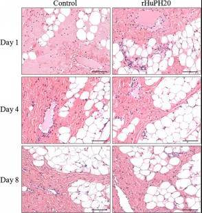 rHuPH20注射部位组织学切片H&E染色对比（对照组vs rHuPH20组）